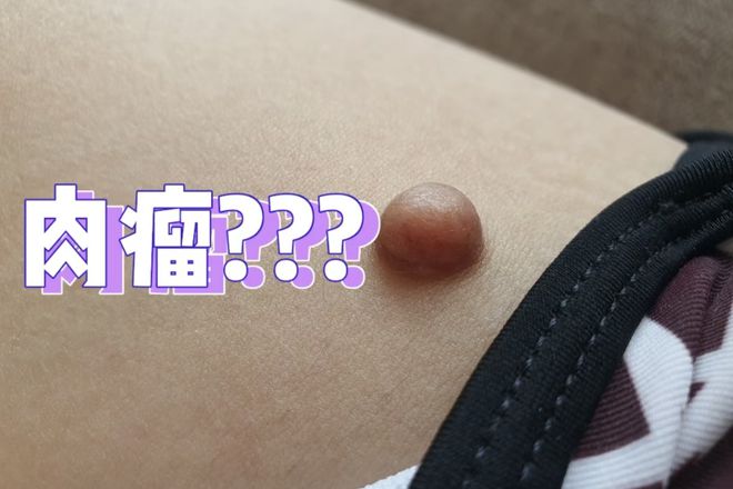 想治疗软组织肉瘤？来上海太安医院中医科试试看(图1)