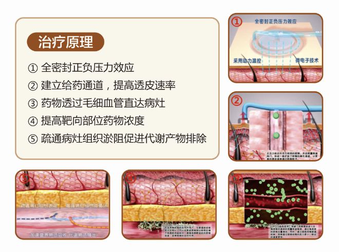 想治疗软组织肉瘤？来上海太安医院中医科试试看(图4)